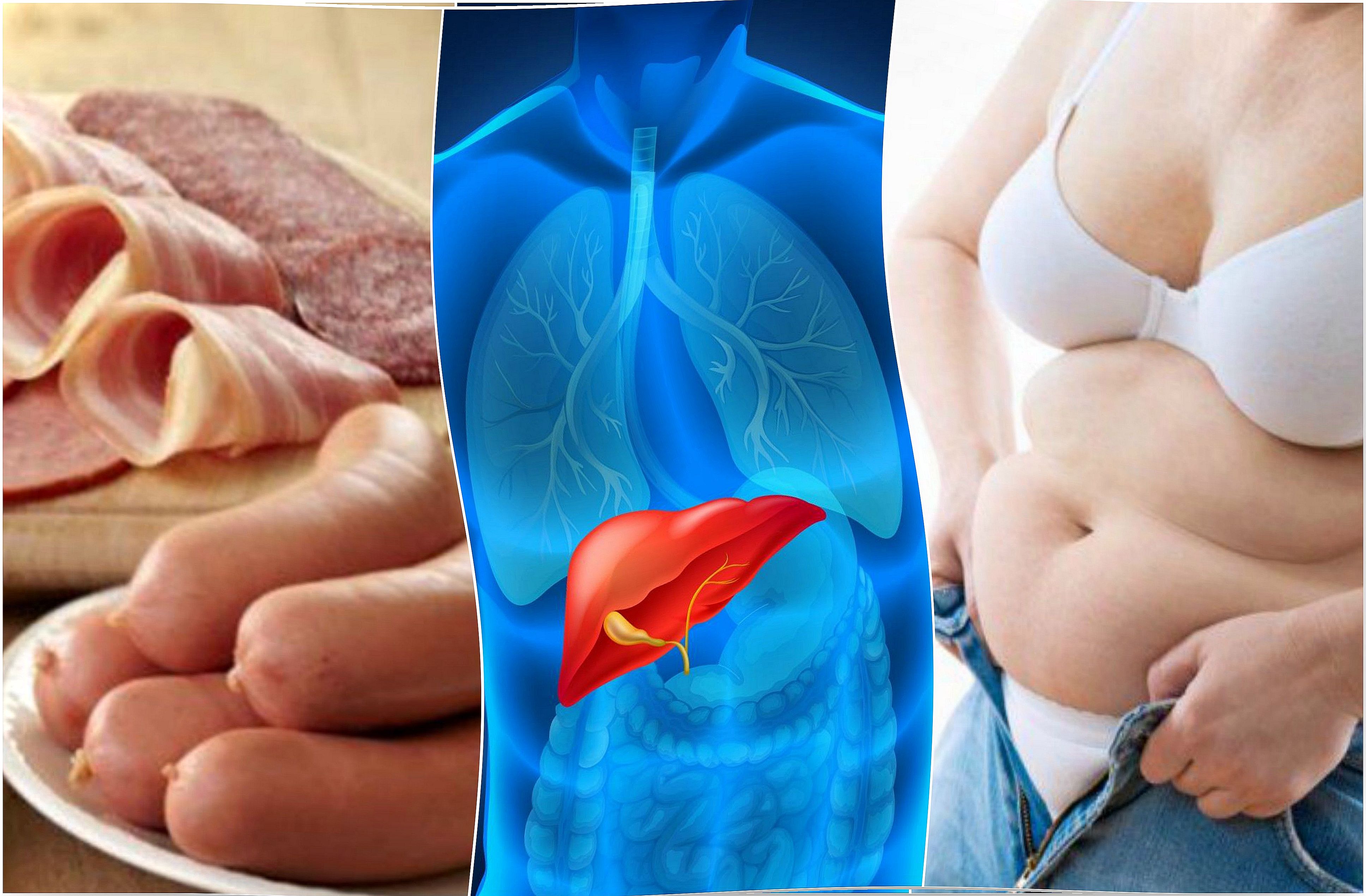 7 things that affect liver health without drinking alcohol