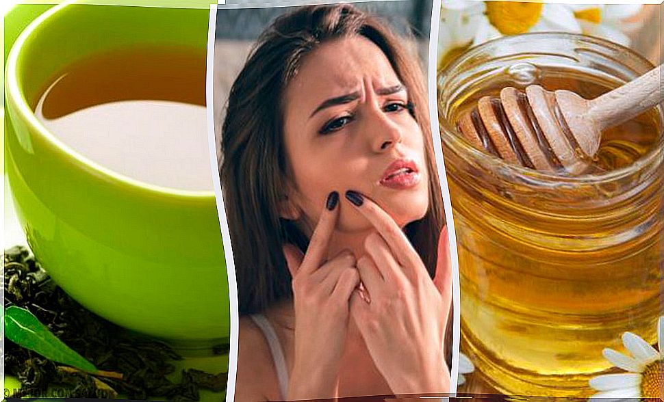 9 effective natural remedies against juvenile acne