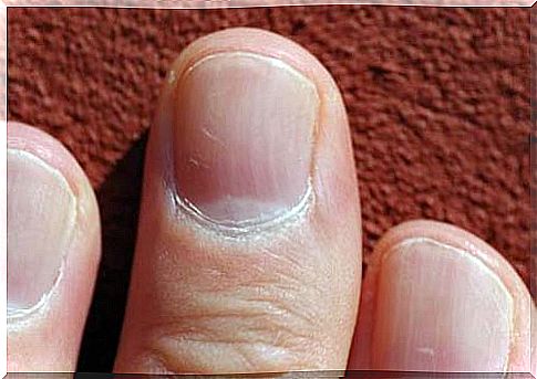 Did you know that the state of your nails can tell a lot about your health?