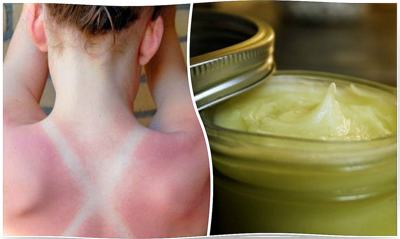 How to make a herbal and honey ointment to relieve burns