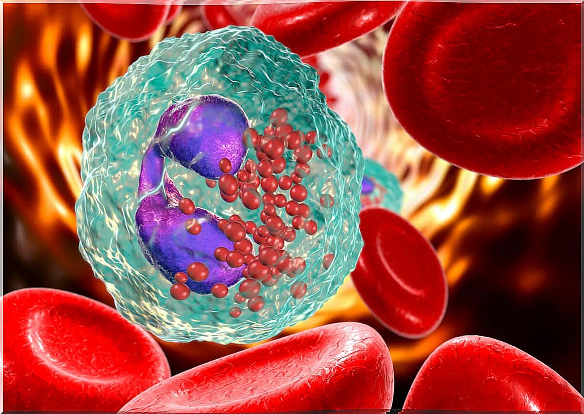 Blood cells affected by medullary aplasia.