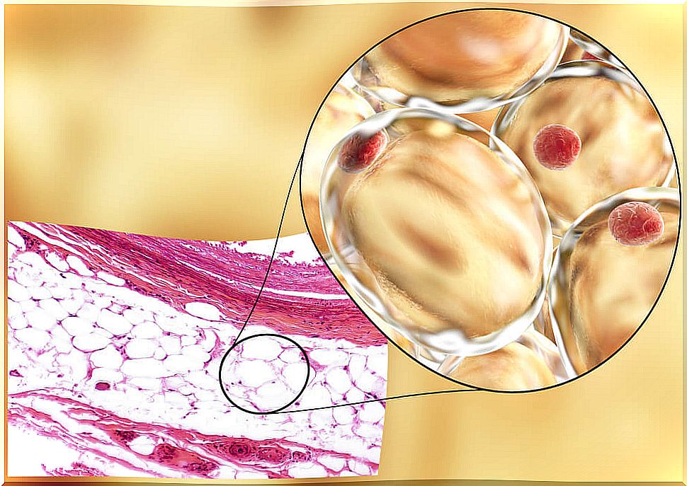 Fructose, glucose and adiponectin