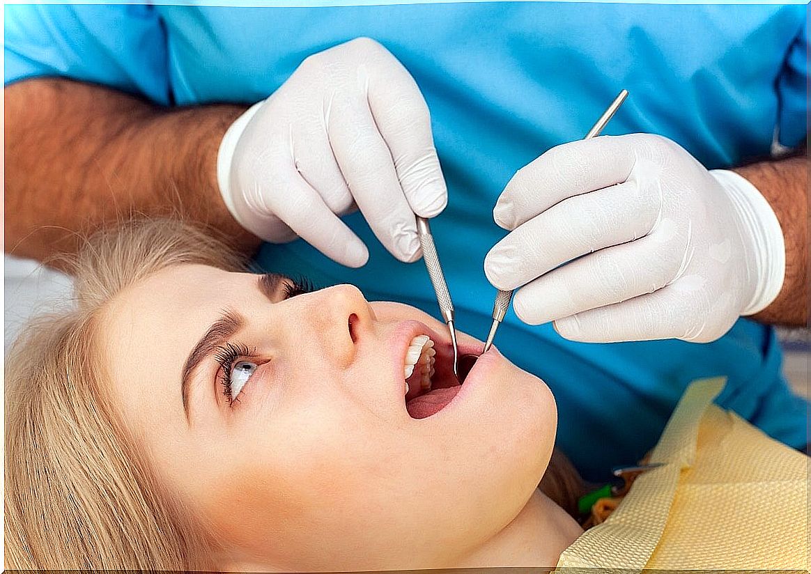 Tooth extraction leading to dry socket.