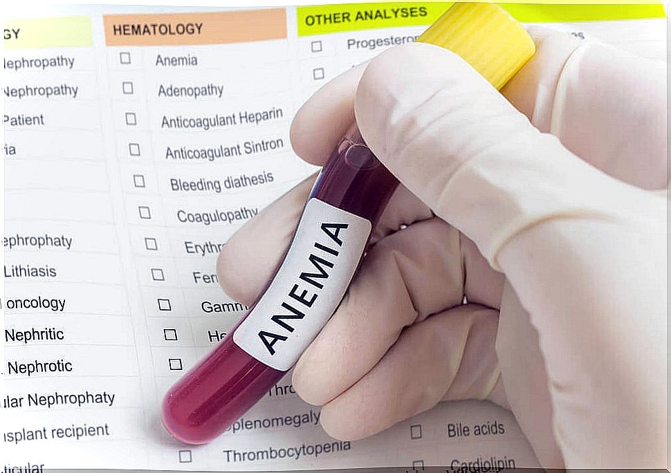 Anemia